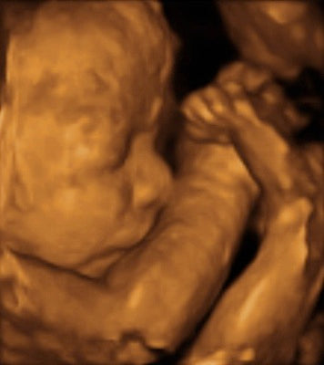 Pregnancy Week image