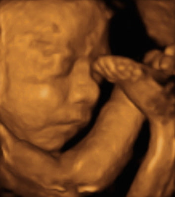 Pregnancy Week image