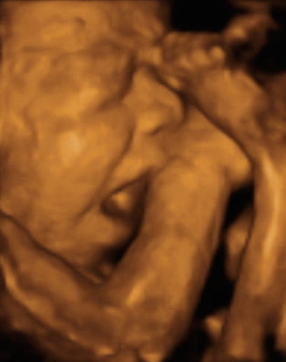 Pregnancy Week image