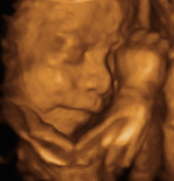 Pregnancy Week image