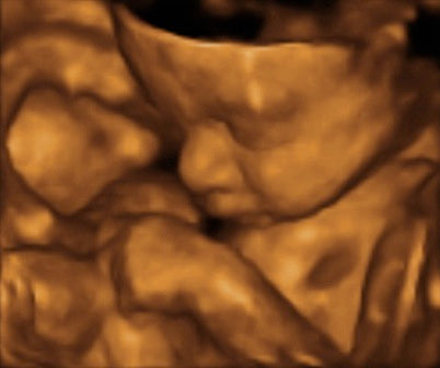 Pregnancy Week image