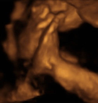 Pregnancy Week image