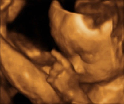 Pregnancy Week image