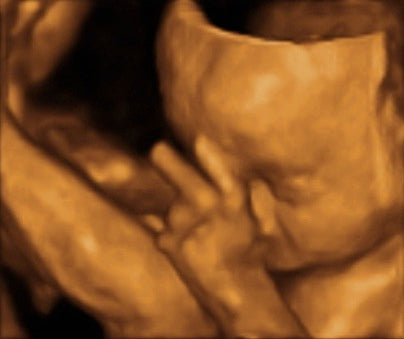 Pregnancy Week image