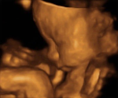 Pregnancy Week image