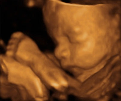 Pregnancy Week image
