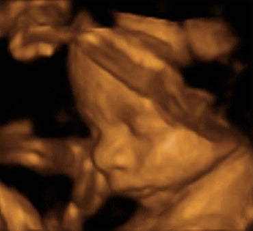Pregnancy Week image