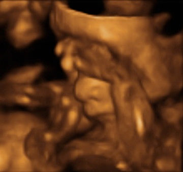 Pregnancy Week image