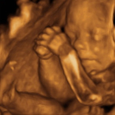 Pregnancy Week image