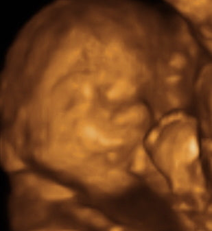 Pregnancy Week image