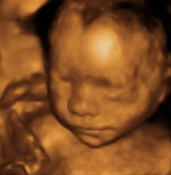 Pregnancy Week image