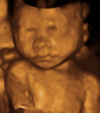 Pregnancy Week image