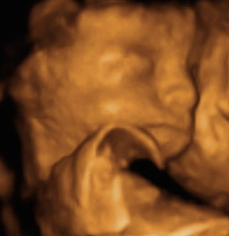 Pregnancy Week image