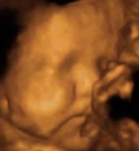 Pregnancy Week image