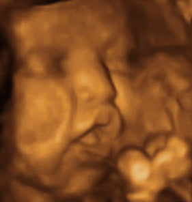 Pregnancy Week image