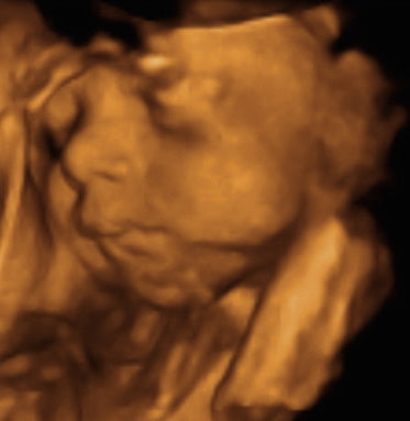 Pregnancy Week image