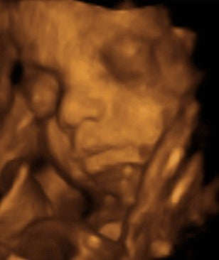 Pregnancy Week image
