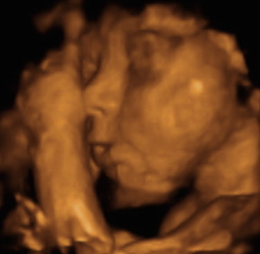 Pregnancy Week image