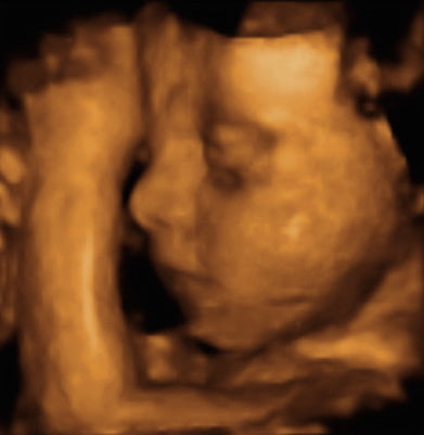 Pregnancy Week image