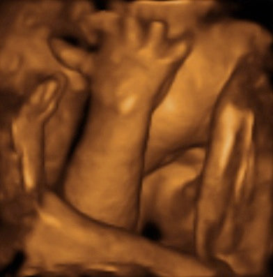 Pregnancy Week image
