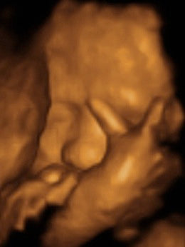 Pregnancy Week image