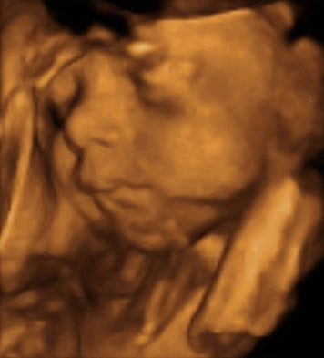 Pregnancy Week image
